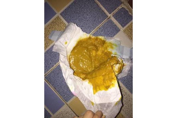 拉屎一天几次正常