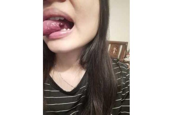 舌头破了怎么办