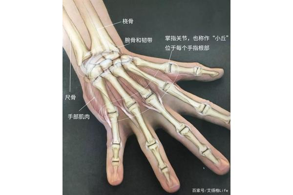 手腕错位图片