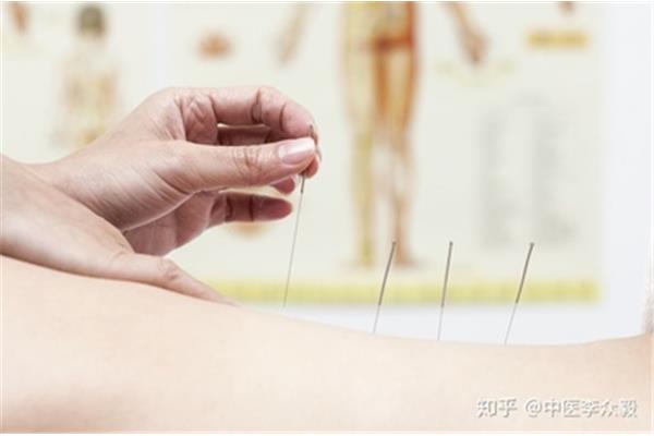 针灸的原理