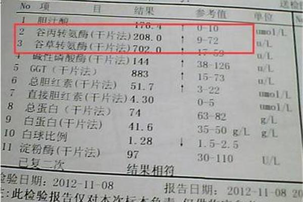 谷丙转氨酶低