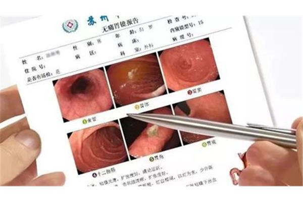 食道怎么检查