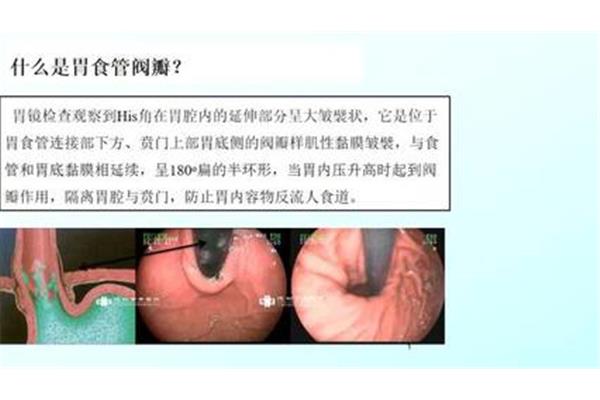 食道怎么检查