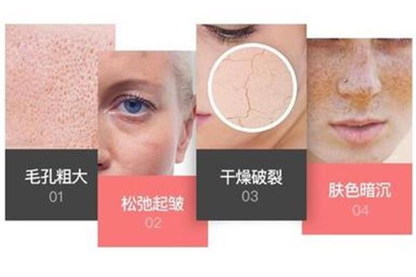 为什么会毛孔粗大