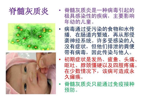 脊髓灰质炎的症状