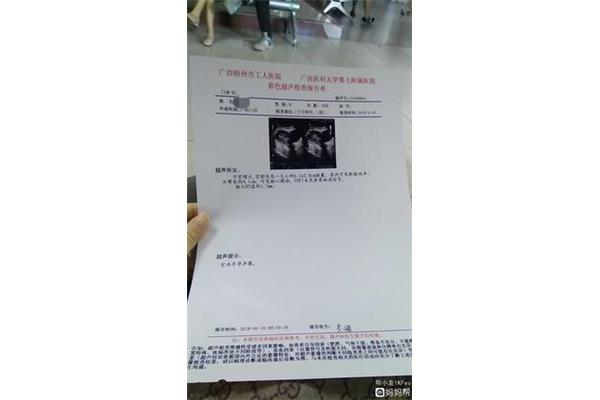 做b超要空腹吗