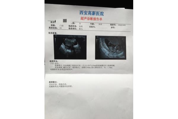 做b超要空腹吗