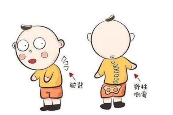 驼背的故事