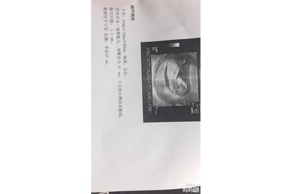 做b超要空腹吗