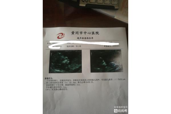 做b超要空腹吗