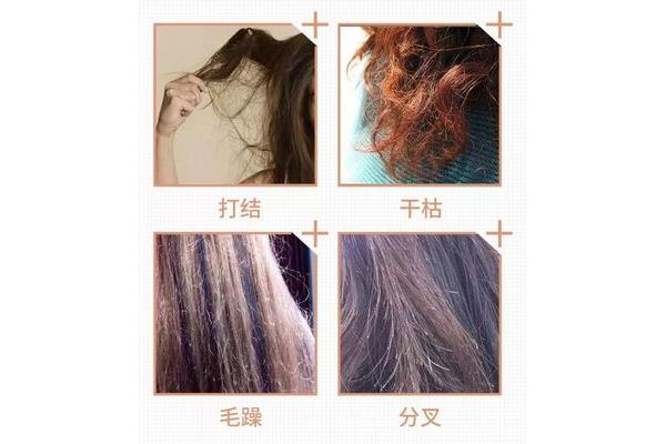 头发分叉的原因