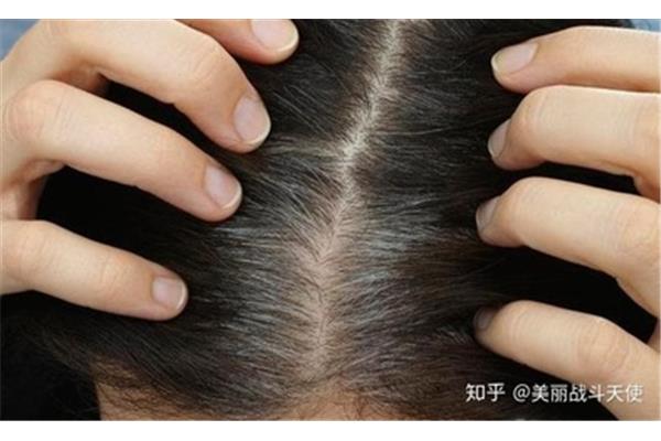 头发分叉的原因