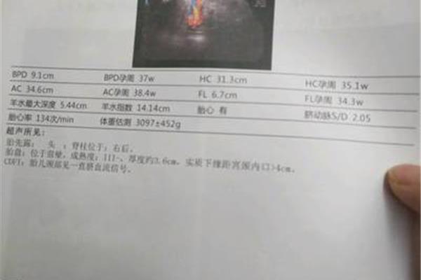 胎儿体重计算