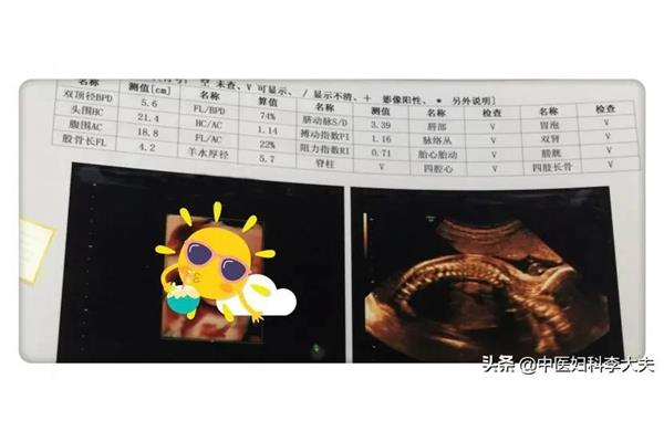 胎儿体重计算