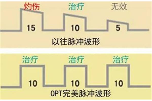灼伤是什么意思