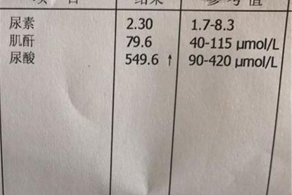 肌酐多少为正常