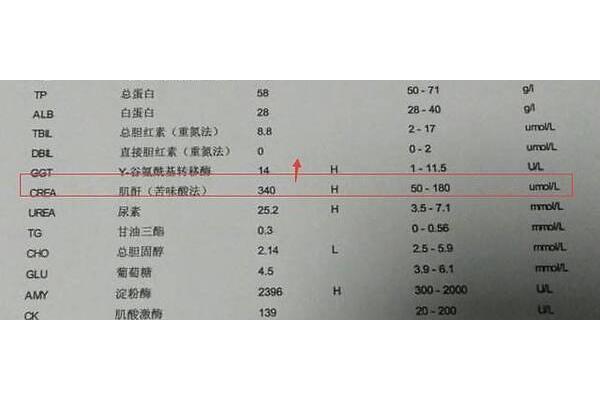 肌酐多少为正常