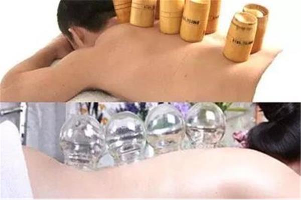 拔罐能洗澡吗