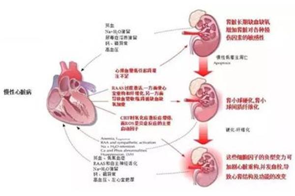 高血压发病机制