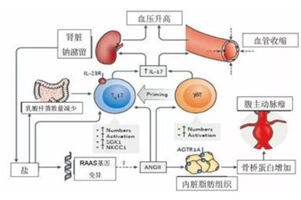 高血压发病机制
