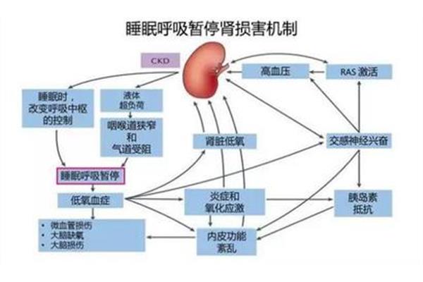 高血压发病机制