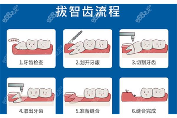 正畸牙齿的流程