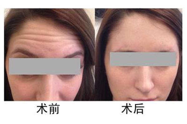 入坑是什么意思