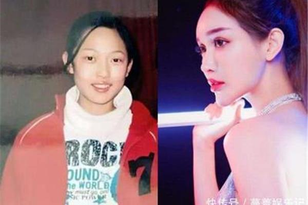 整容的危害