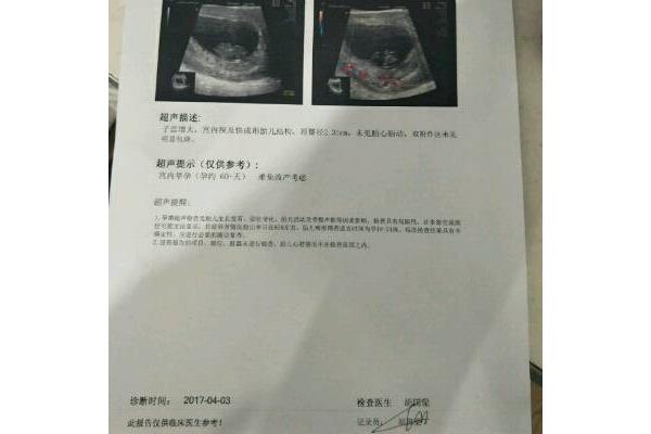 孕吐从第几周开始