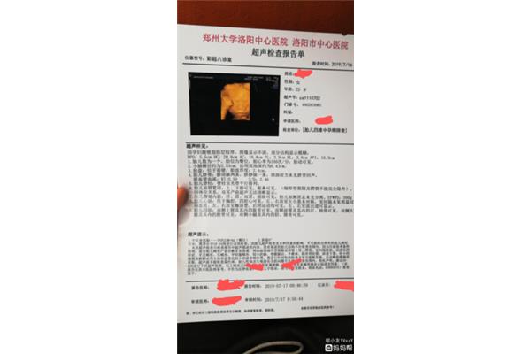 四维排畸哪里做
