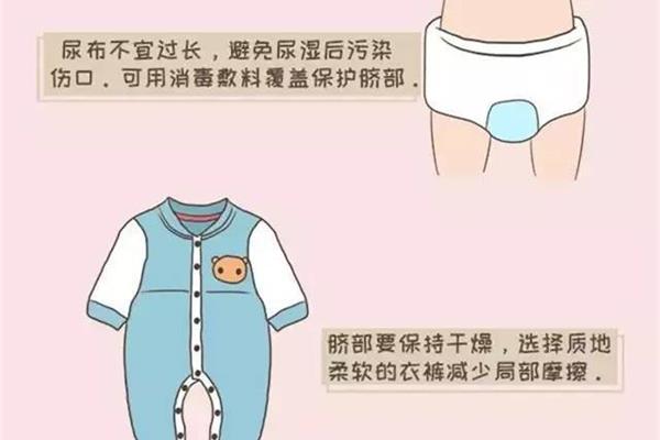 脐带一般多久脱落