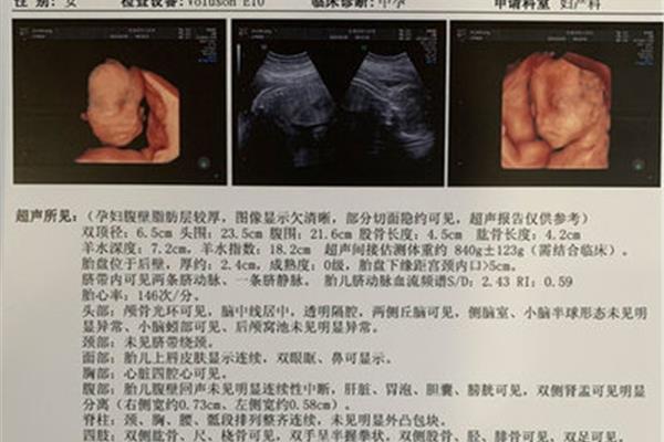 四维排畸哪里做