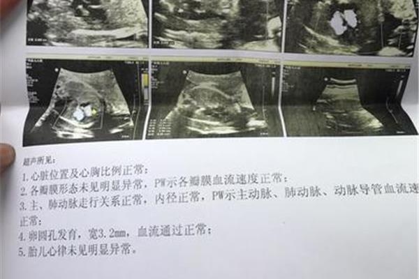 四维排畸哪里做