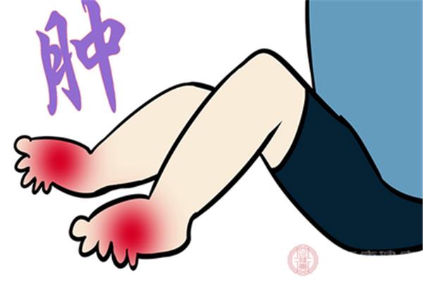 扭伤可以热敷吗