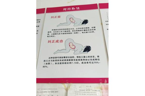 纠正胎位姿势图