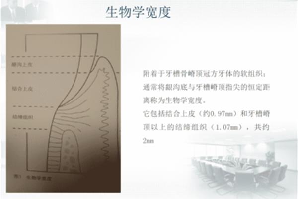 生物学宽度