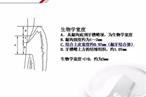 生物学宽度