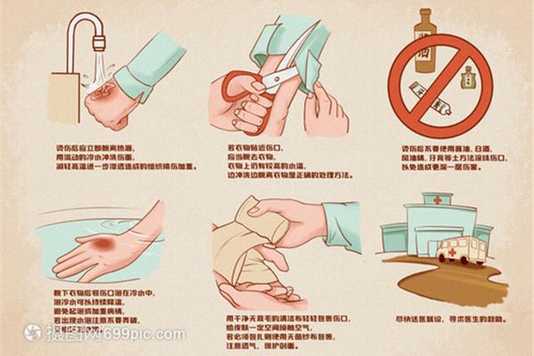 烫伤的治疗方法