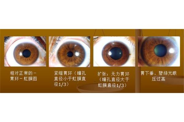 瞳孔大小正常值