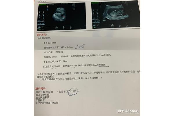胎停的概率有多大