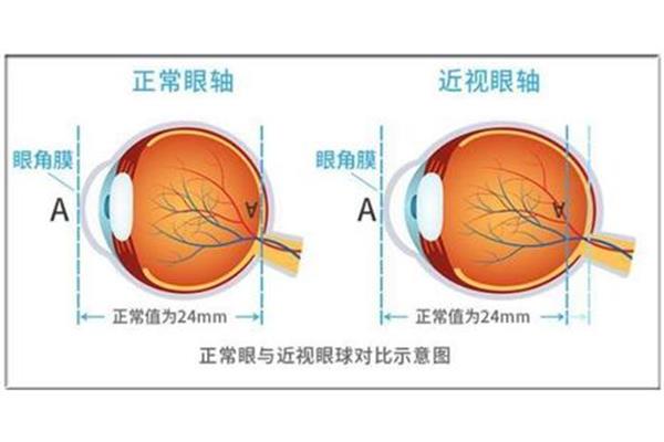 瞳孔大小正常值