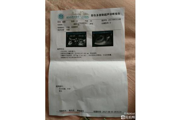 胎停的概率有多大