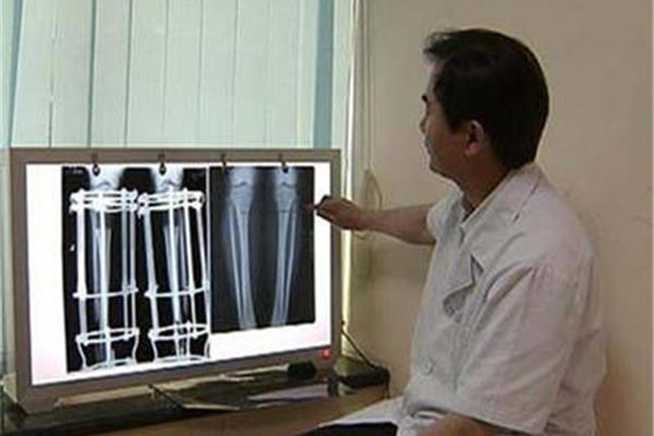 骨骺线怎么检查