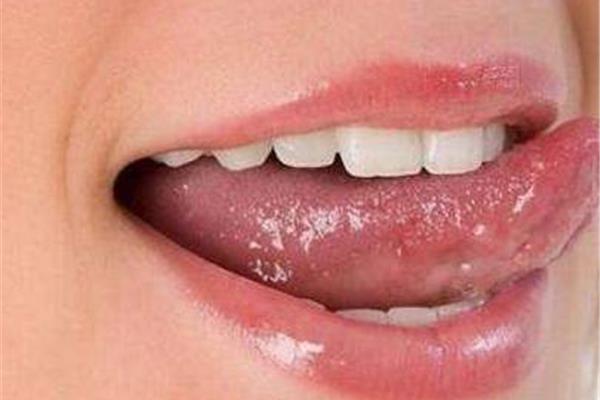舌头侧面疼