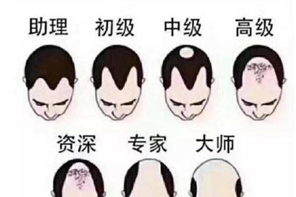为什么会秃顶
