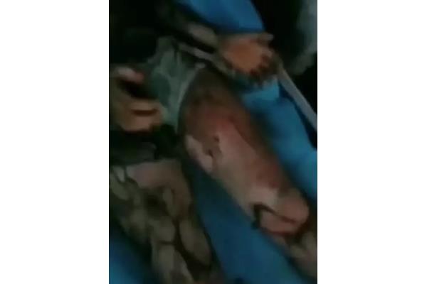 手机爆炸伤人图片