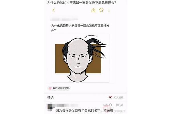 为什么会秃顶