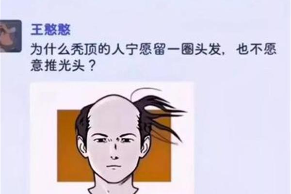 为什么会秃顶