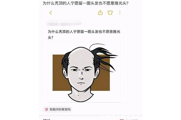 为什么会秃顶