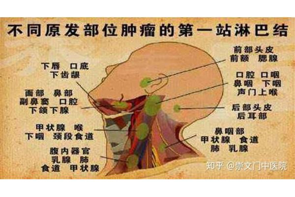 淋巴结核是什么病